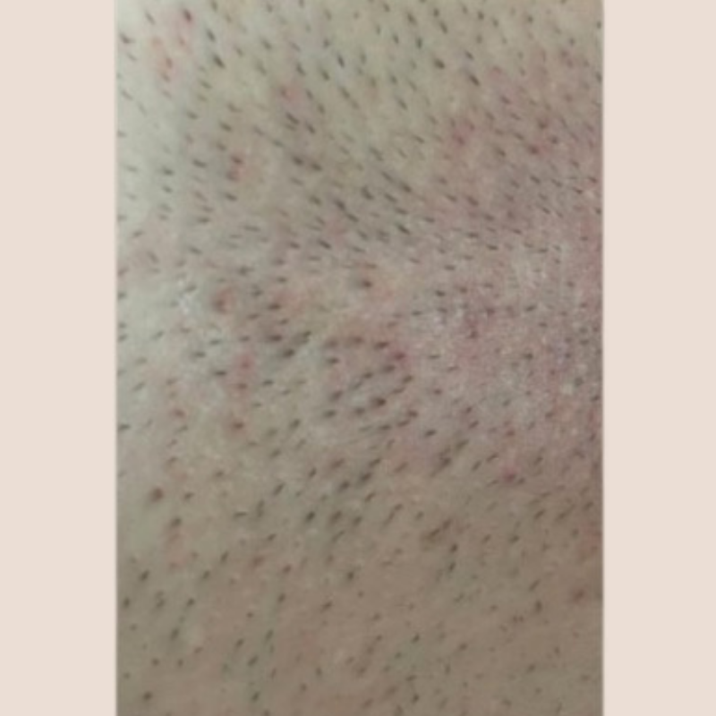 image comparison before