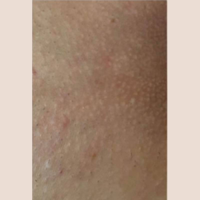 image comparison after