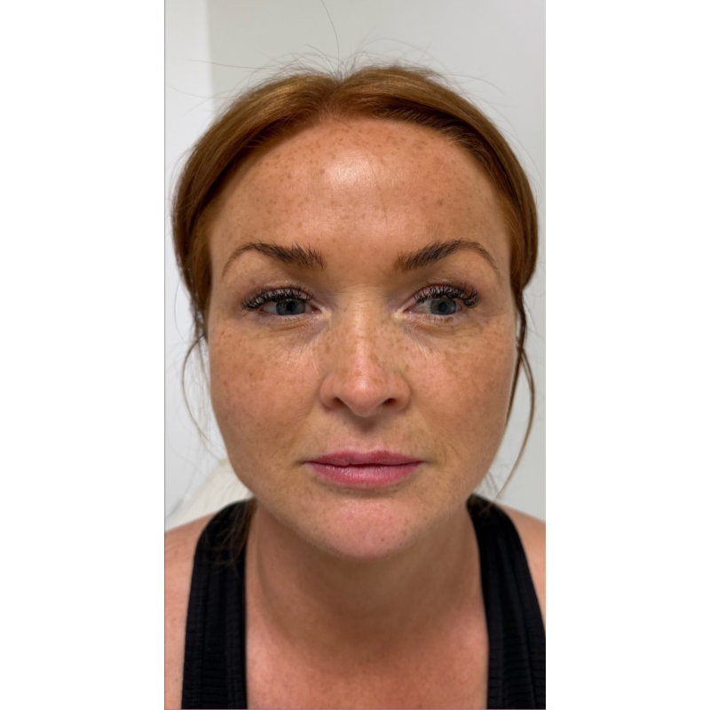 image comparison before