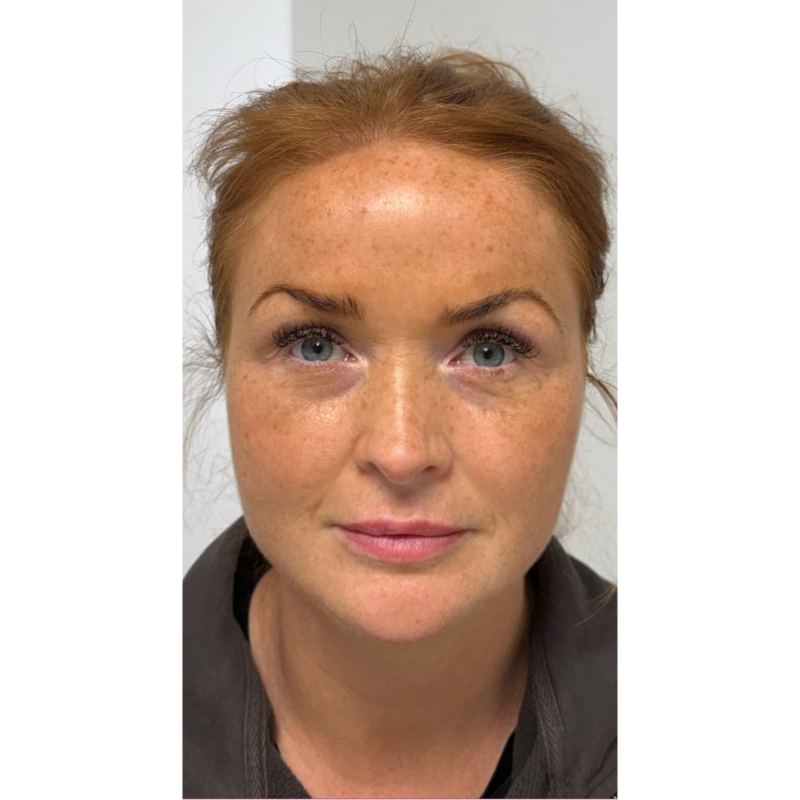 image comparison after