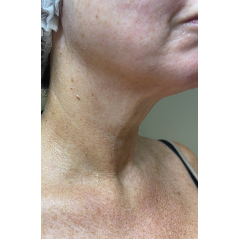 image comparison after