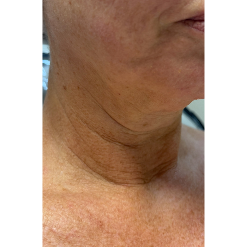 image comparison before