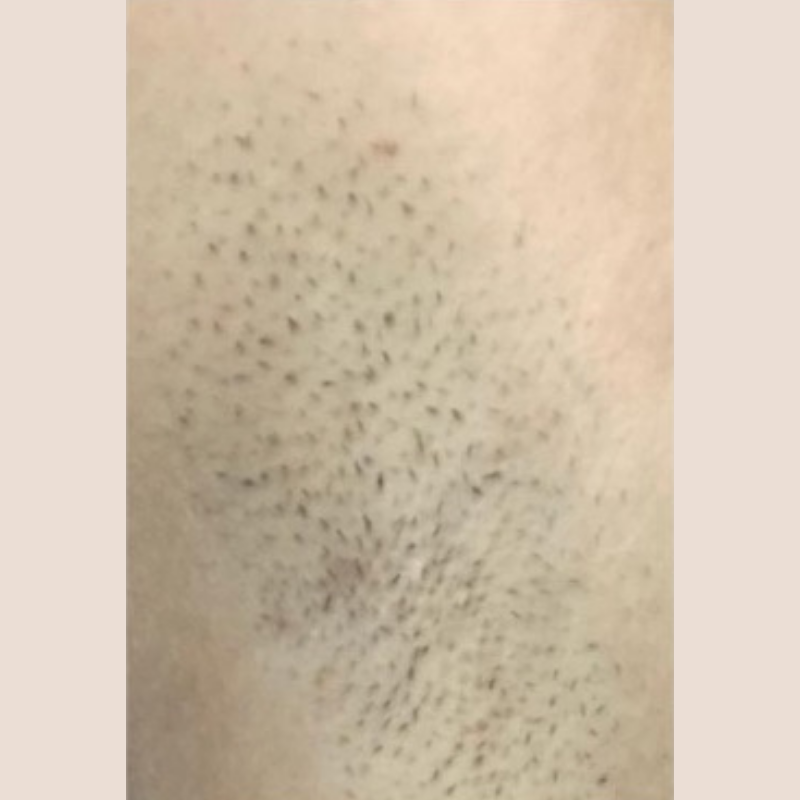 image comparison before