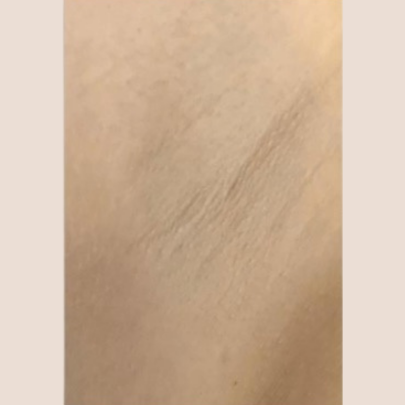 image comparison after